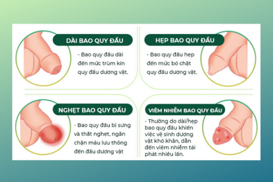 bao-quy-dau.png