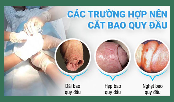 co-nen-cat-bao-quy-dau-khong-1.png